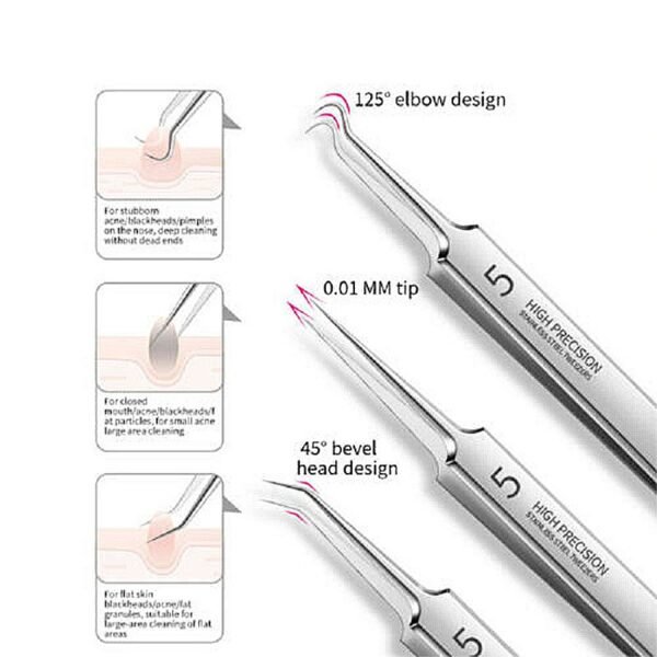 Ultra-Fine Acne Needle Set with Tweezers, Pimple and Blackhead Removal Tools - Image 2