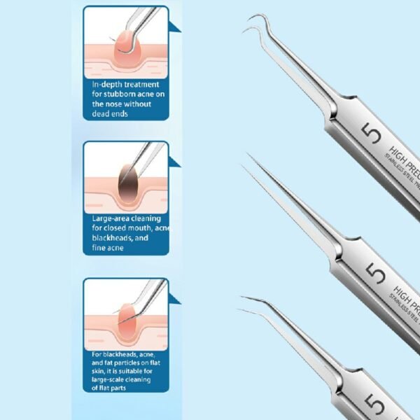 Ultra-Fine Acne Needle Set with Tweezers, Pimple and Blackhead Removal Tools - Image 9